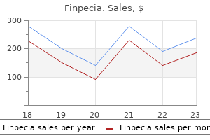 finpecia 1 mg buy free shipping