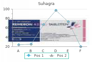 order generic suhagra line