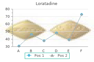 discount loratadine 10 mg otc